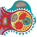 Nephrotic Syndrome